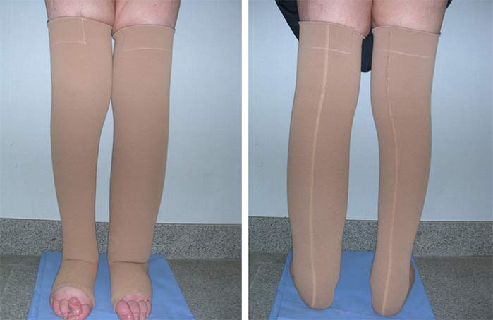 Le calze ed i tutori elastici: il benessere per le tue gambe